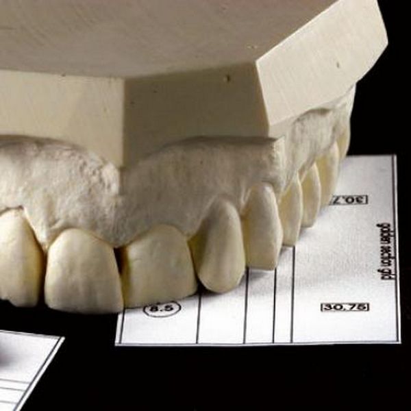 Golden Section Divider